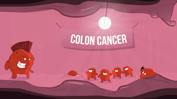 “Trust Your Gut” Colon Cancer Explainer Video